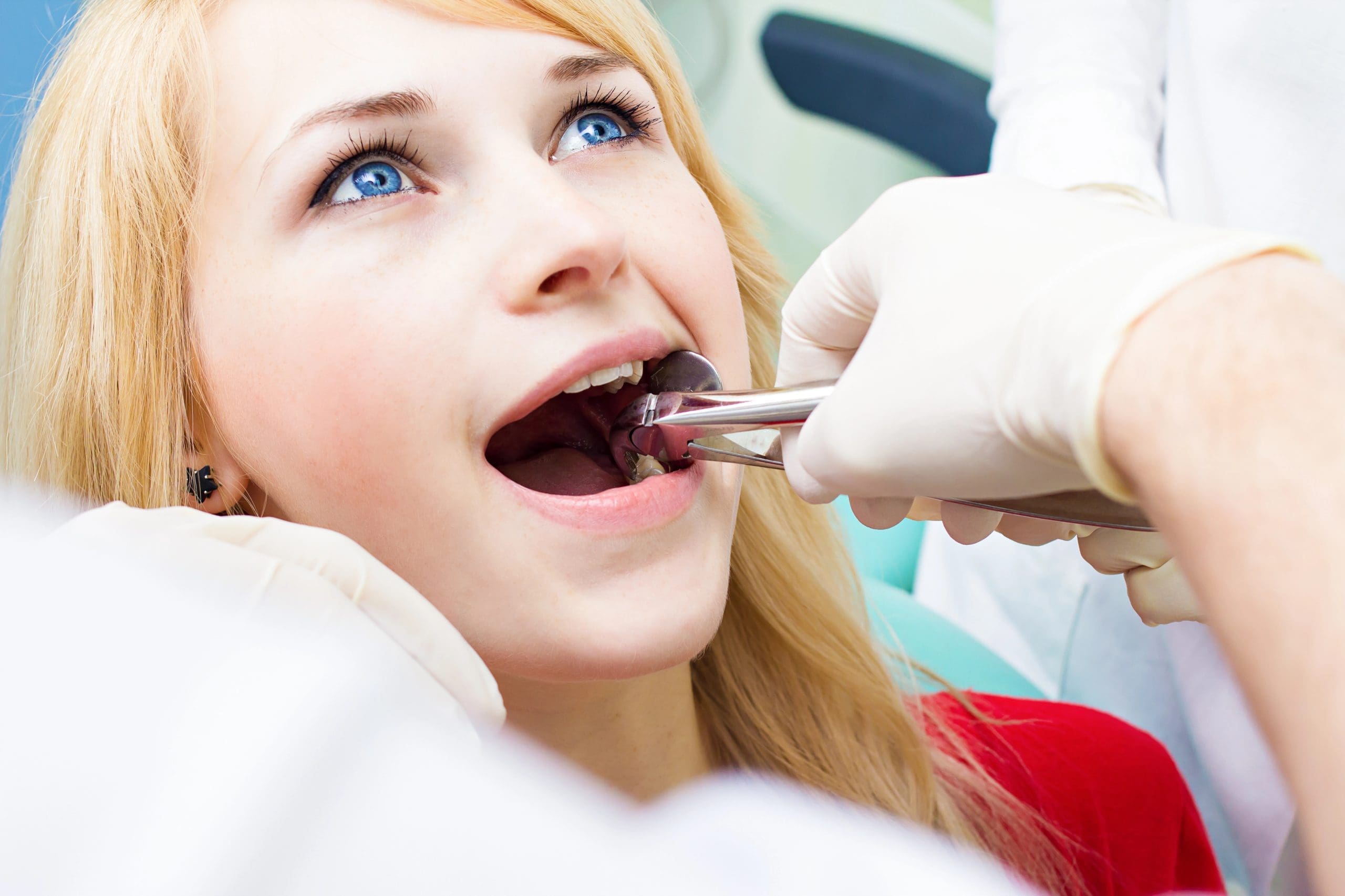 Fort Worth Tooth Extractions