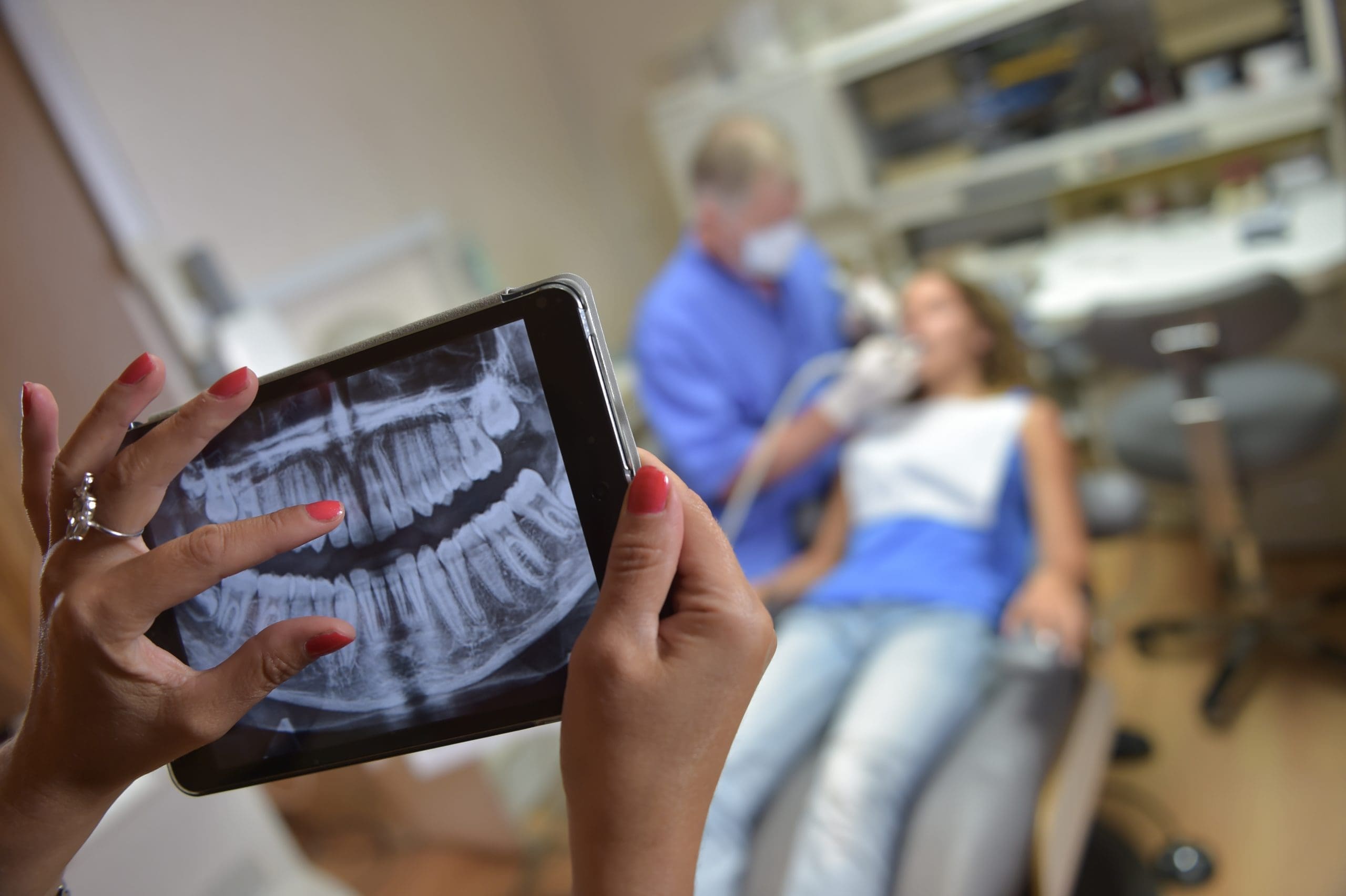 Digital X-rays benefits: Why Choose Them?