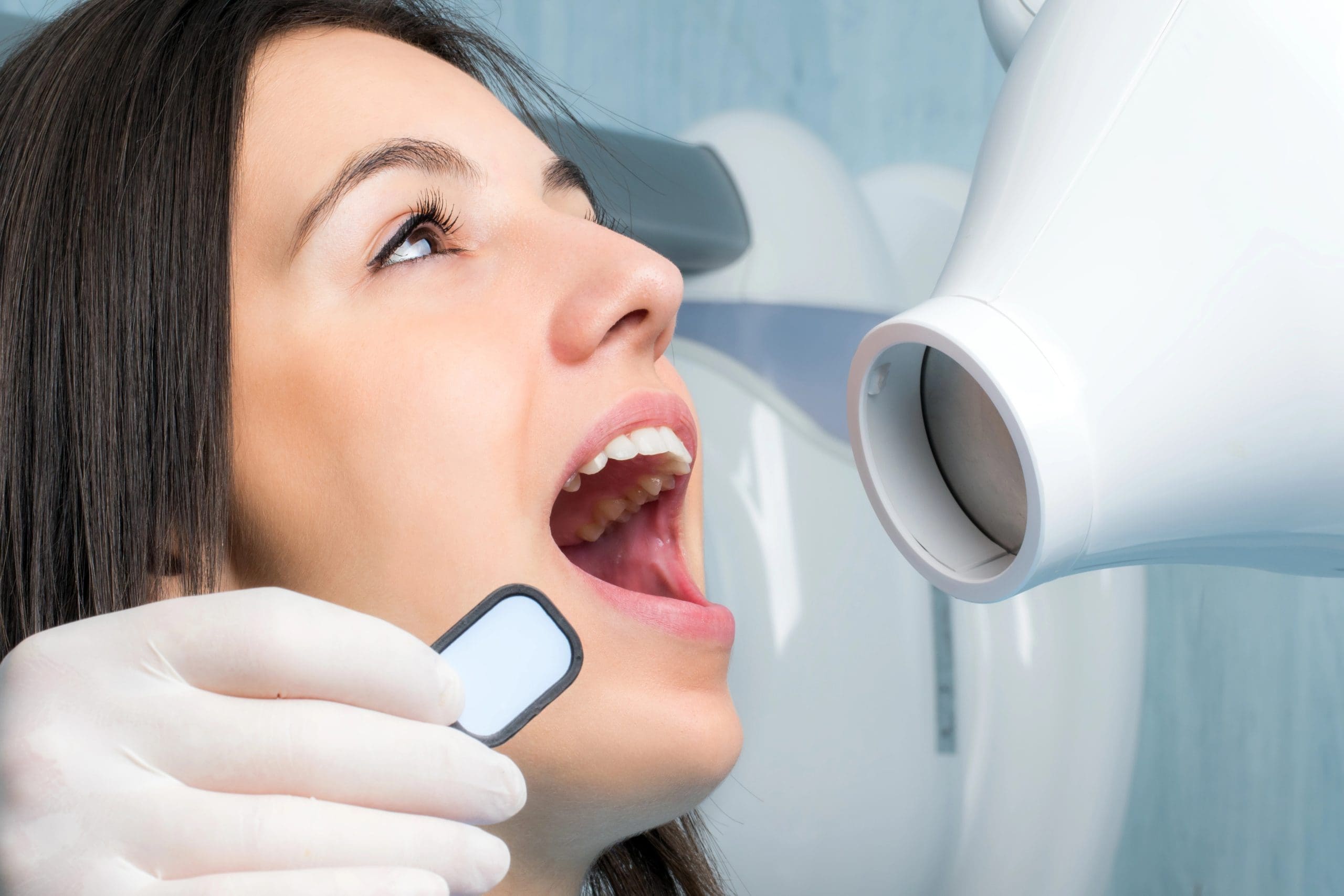 Digital dental X-rays: What to Expect